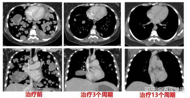 间歇性厌友症，症状、成因及应对策略探索